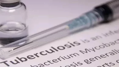 WHO Global Tuberculosis Report 2023 UPSC