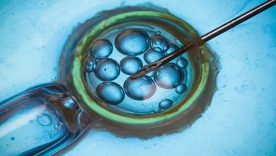 Assisted Reproductive Technology UPSC