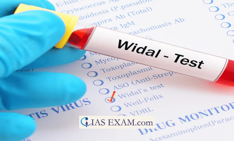 Widal test obscures India's Typhoid Awareness UPSC