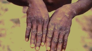 Monkeypox Cases expected to increase - WHO UPSC